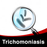 Individuele behandeling tegen Trichomoniasis bij duiven